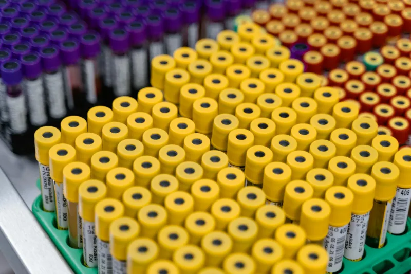 Special Delivery: The Vermont Man Who Shipped His Severed Leg Through the U.S. Mail